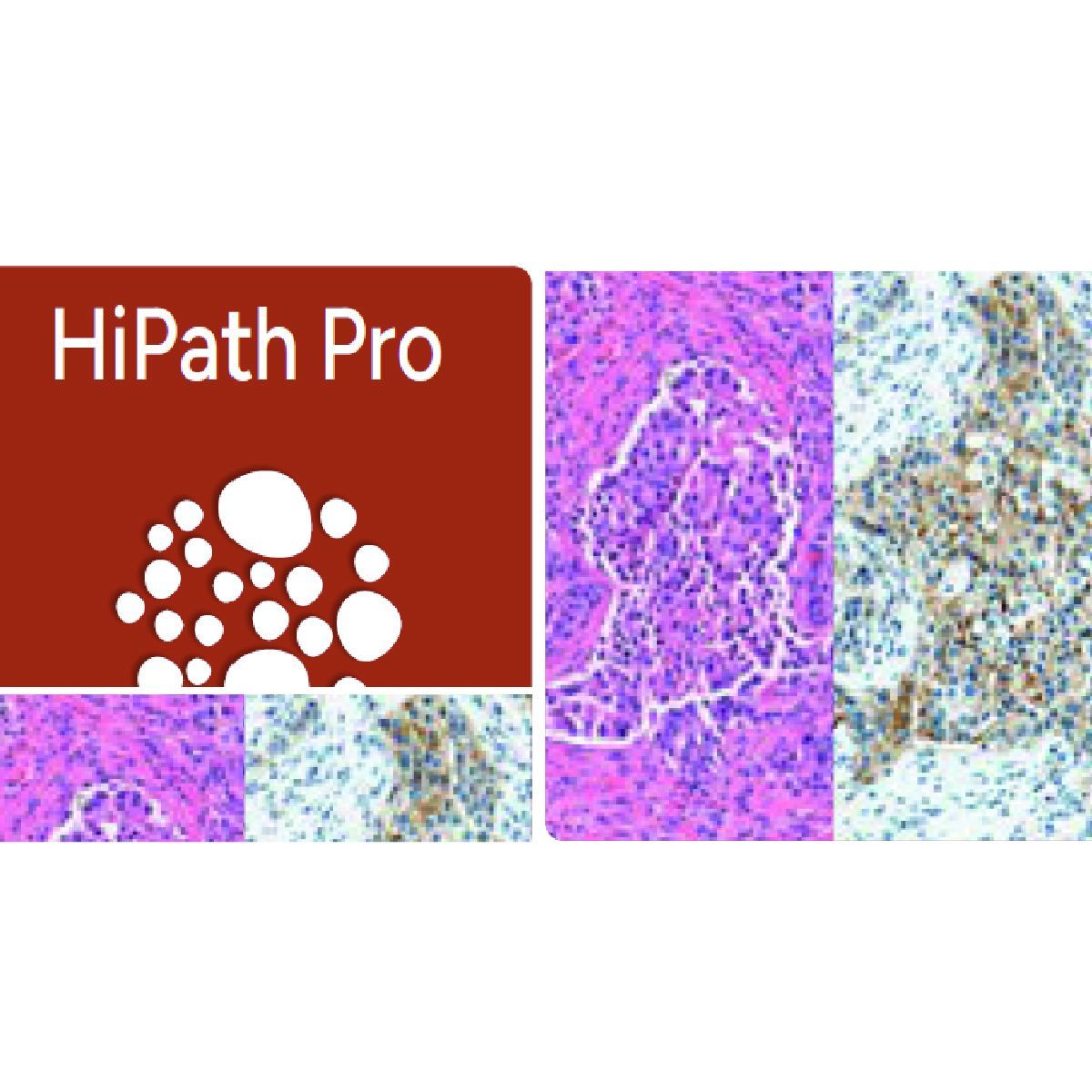 HiPath Pro
