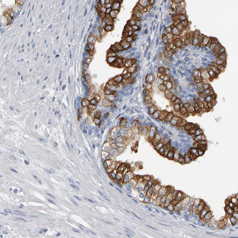 CD38
