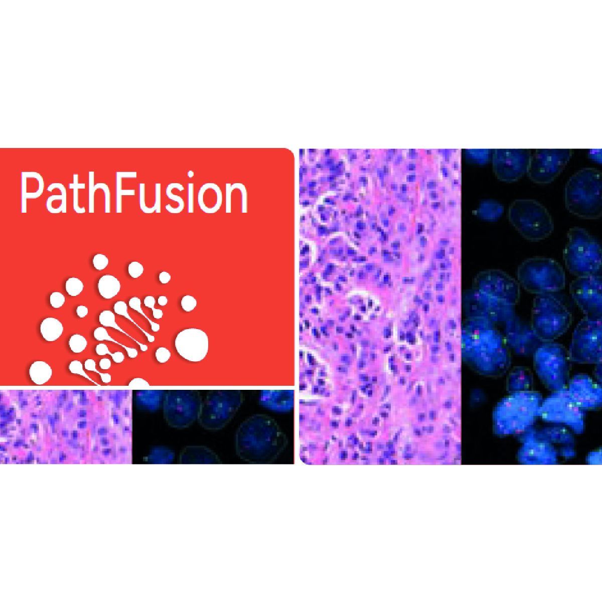 PathFusion
