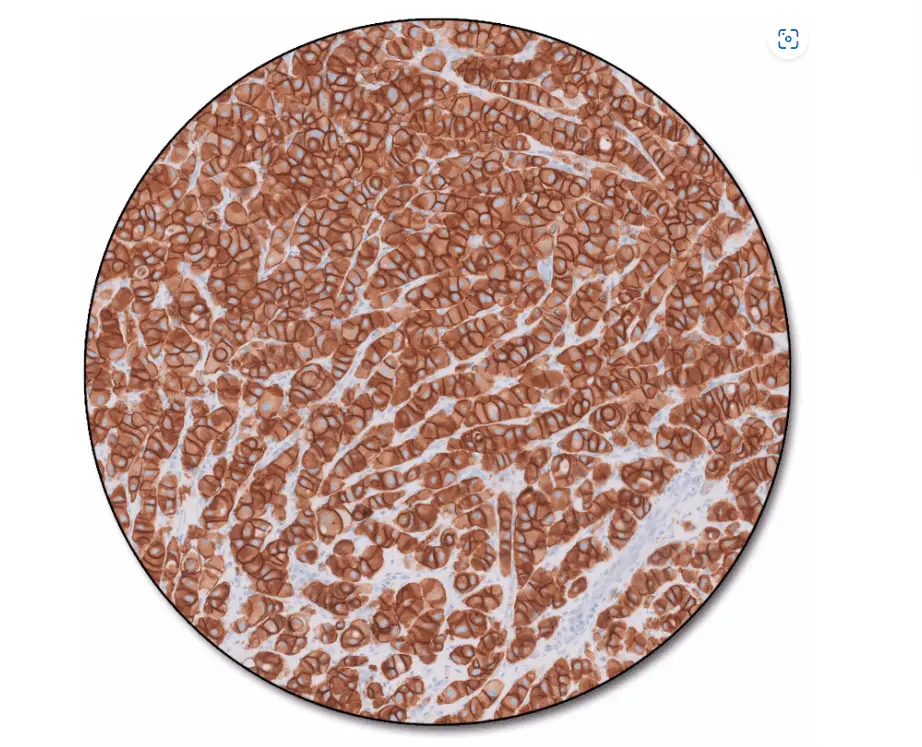 HercepTest™ mAb pharmDx (Dako Omnis)